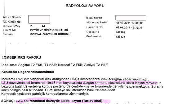 Bel Fıtığı Raporu